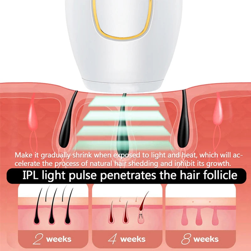 Illustration of IPL hair removal device with hair follicle diagram and text explaining hair growth inhibition.